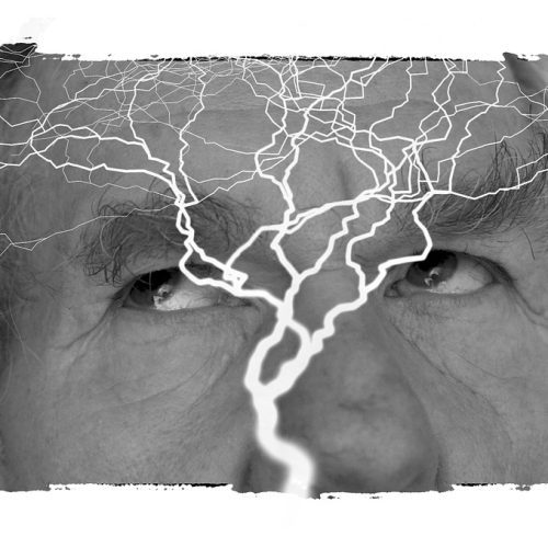 Epilepsia y Trastorno Disociativo: Relación y Consideraciones Clínicas